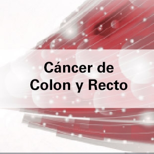 El cáncer de colon